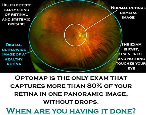 Close up of Retina Scan using Optomap