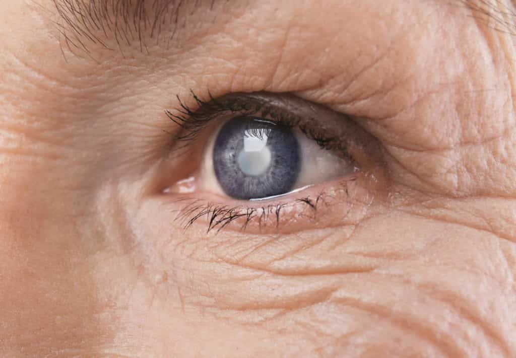 close up of an elderly persons eye