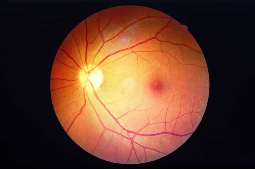 close up of an optic nerve