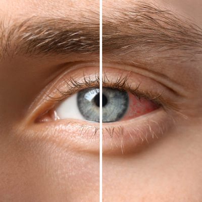 Young man with blue eyes, closeup